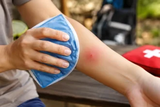 Red Wasp Sting What to Do & When to Seek Help