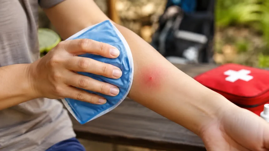 Red Wasp Sting What to Do & When to Seek Help
